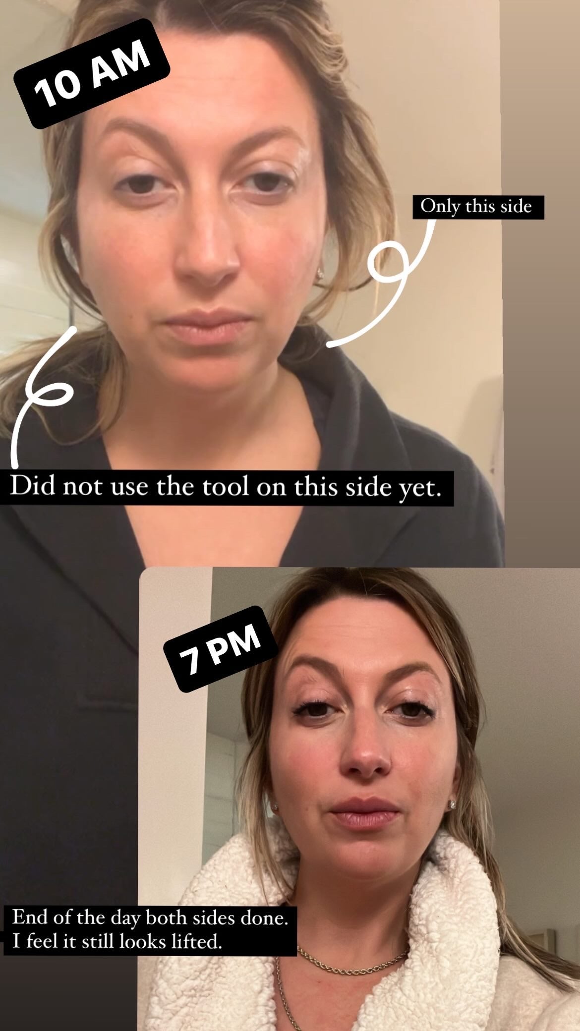 LED Face & Neck Sculpting Device