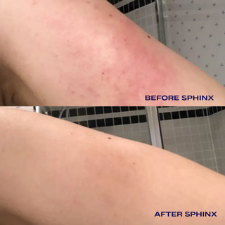 Luna Nectar Sphinx Body Oil for Eczema and Rosacea Relief