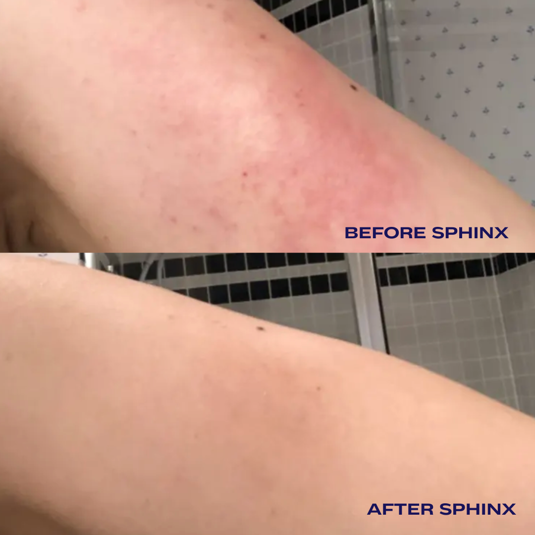 Luna Nectar Sphinx Body Oil for Eczema and Rosacea Relief