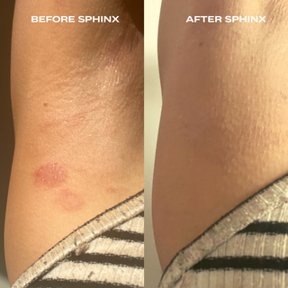 Luna Nectar Sphinx Body Oil for Eczema and Rosacea Relief