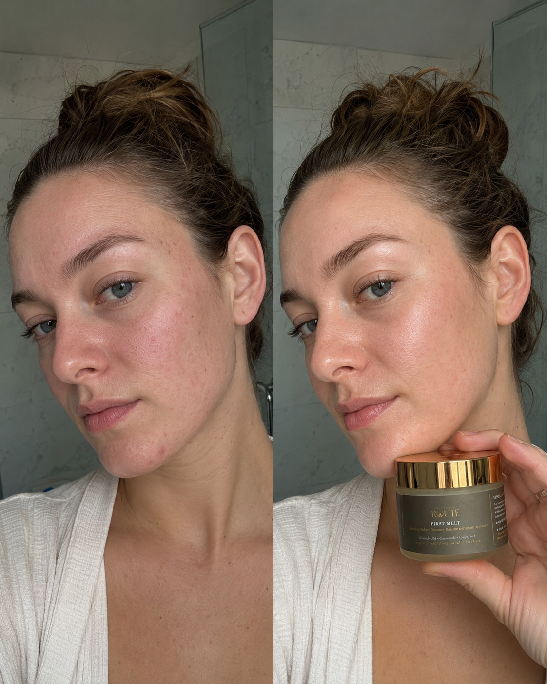 FIRST MELT before and after results