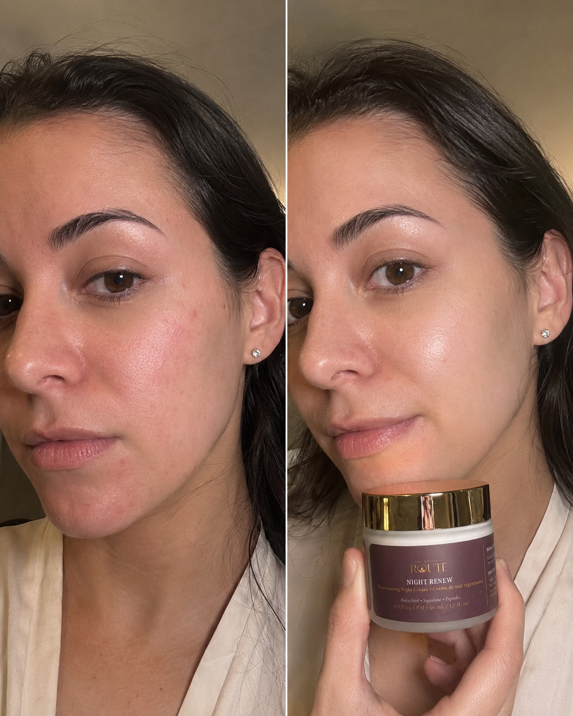 NIGHT RENEW before and after results